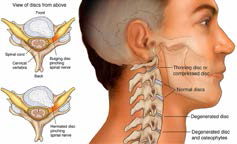 Constant neglect of the neck or sudden trauma or other conditions affecting the bones