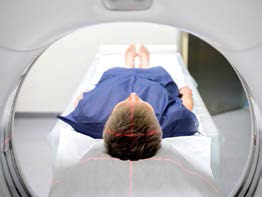 BRAIN BLEED Case study by Apollo Hospital