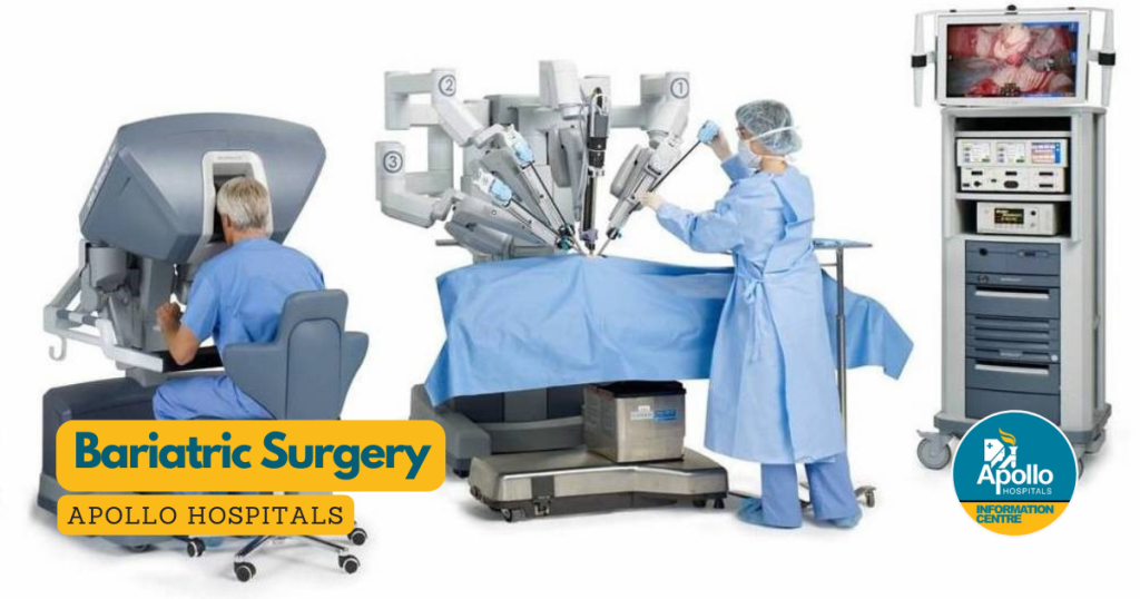 Bariatric Surgery India Apollo Hospitals