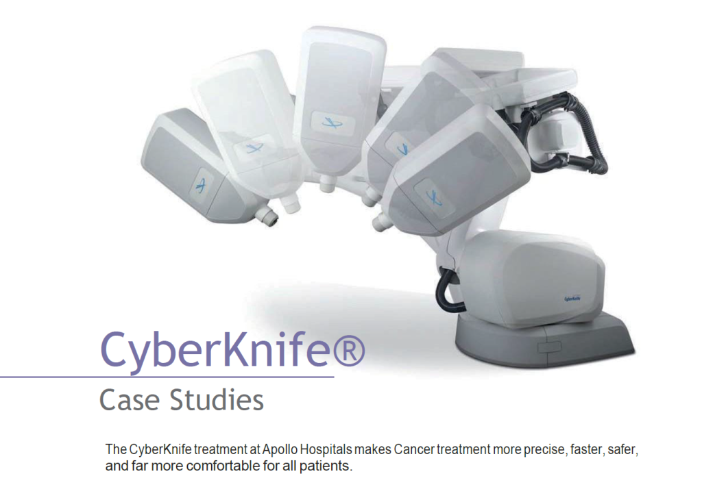 The CyberKnife treatment at Apollo Hospitals