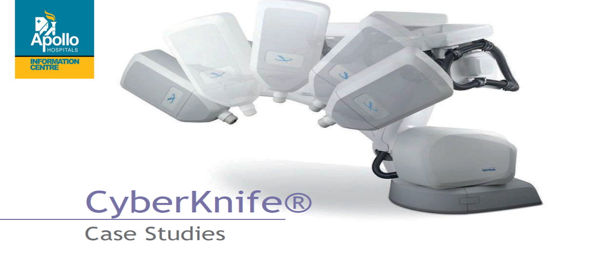 CyberKnife Case Studies by Apollo Hospitals for cancer treatments