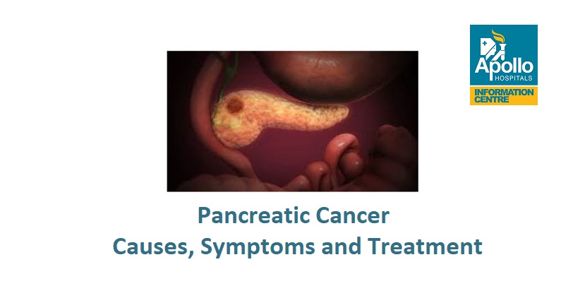 Pancreatic Cancer in Kenya - Causes, Symptoms, and Treatment