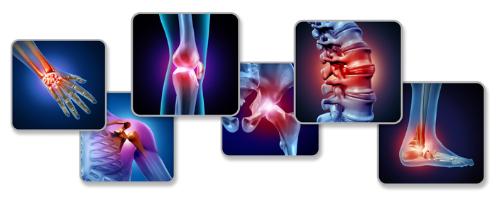 Best Orthopedic Hospital in Kenya - Orthopedic Surgeons