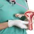 Best cervical cancer treatment center in Kenya