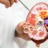 Top Kidney Transplant Treatment in India for Kenyan Patients