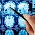 Best Neurology and Neurosurgery Hospital Centre in Uganda