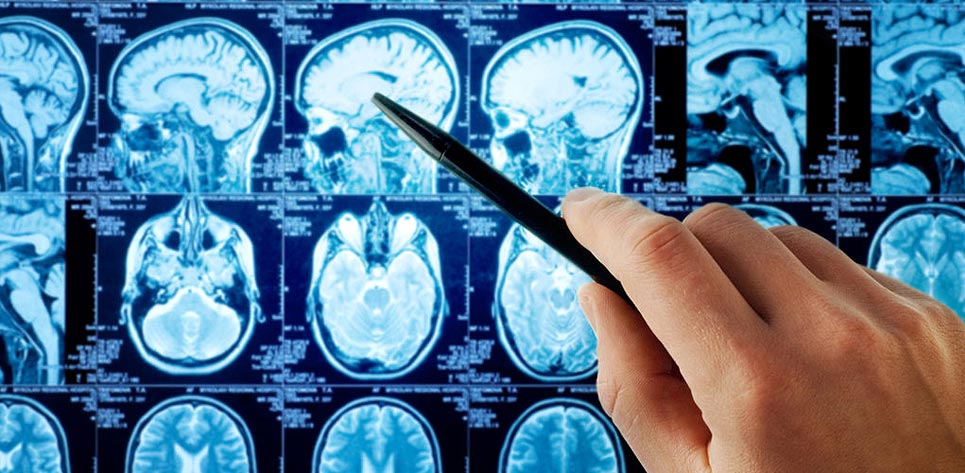 Best Neurology and Neurosurgery Hospital Centre in Uganda