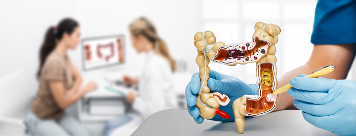 Best Colon Cancer Treatment Hospital Centre in Nairobi, Kenya